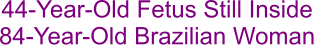 44-Year-Old Fetus Still Inside  84-Year-Old Brazilian Woman